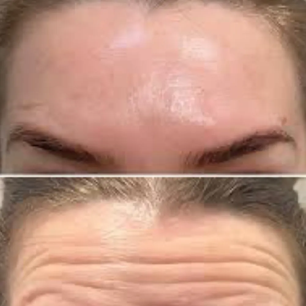 RISE Skin Rejuvenation and Body Sculpting