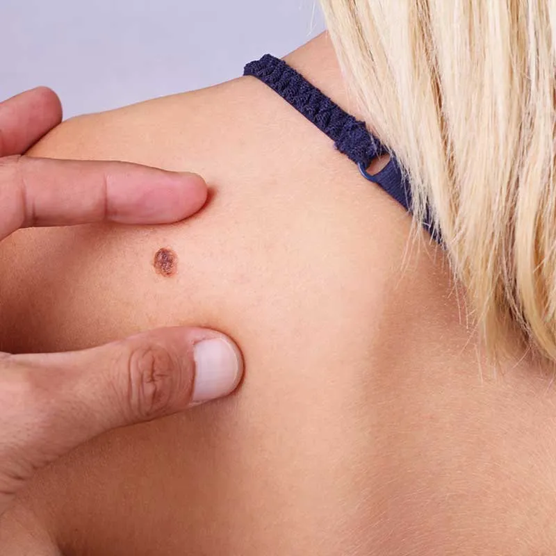 Clear Dermatology