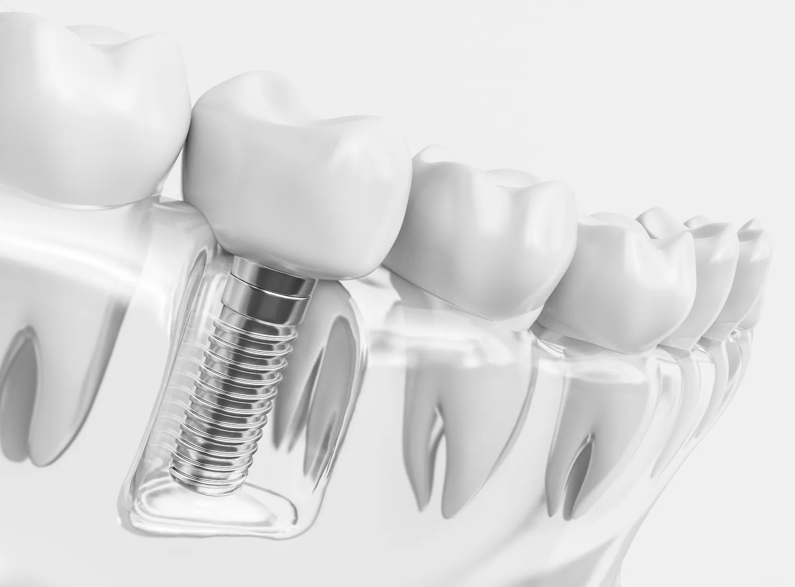 Laser Dentistry of Erie