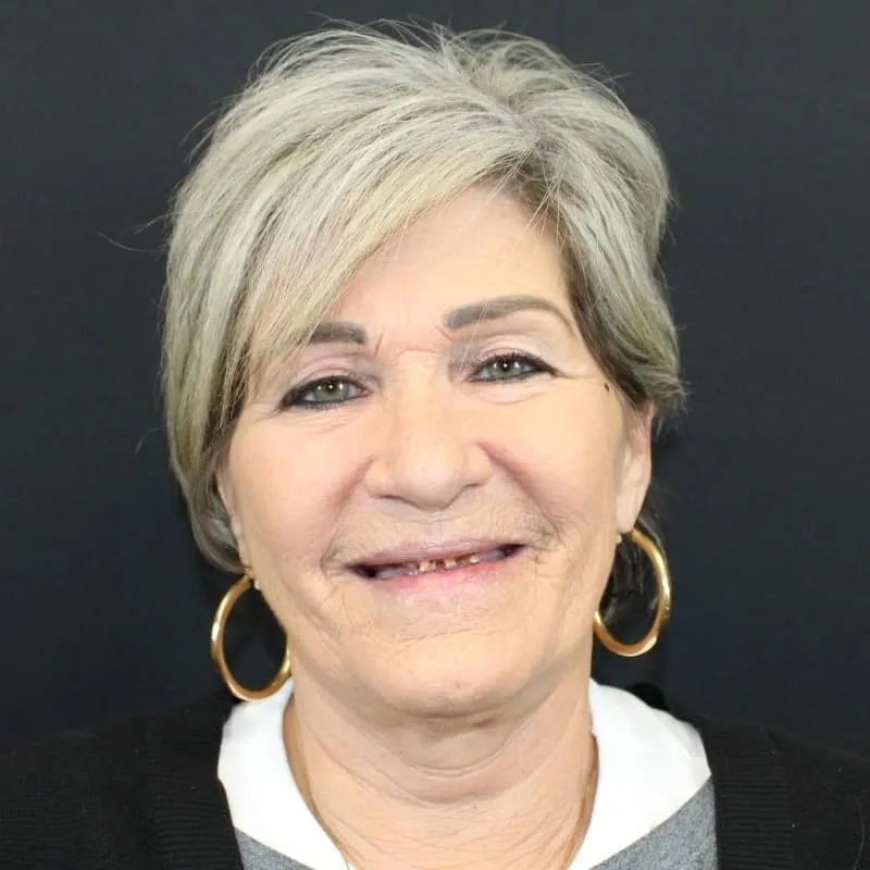Columbus Dentures and Implants