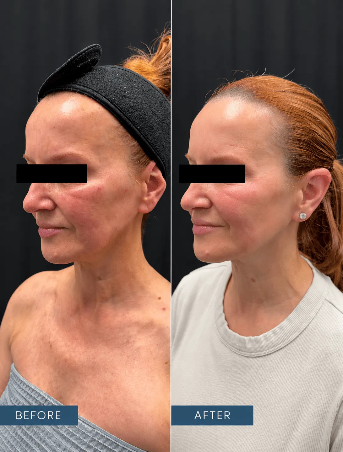 Contour You Med Spa