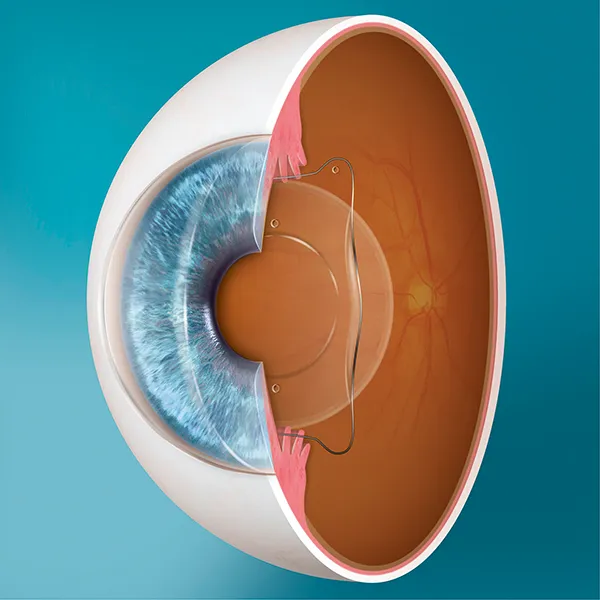 Price Vision Group