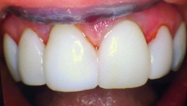 Clearwater Dentist