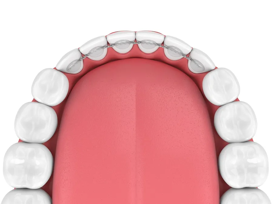 Emergency Dental of Colorado Springs