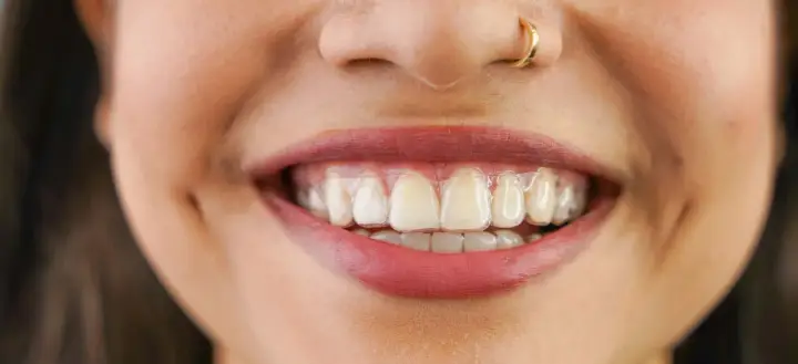 Yenne & Schofield Orthodontics