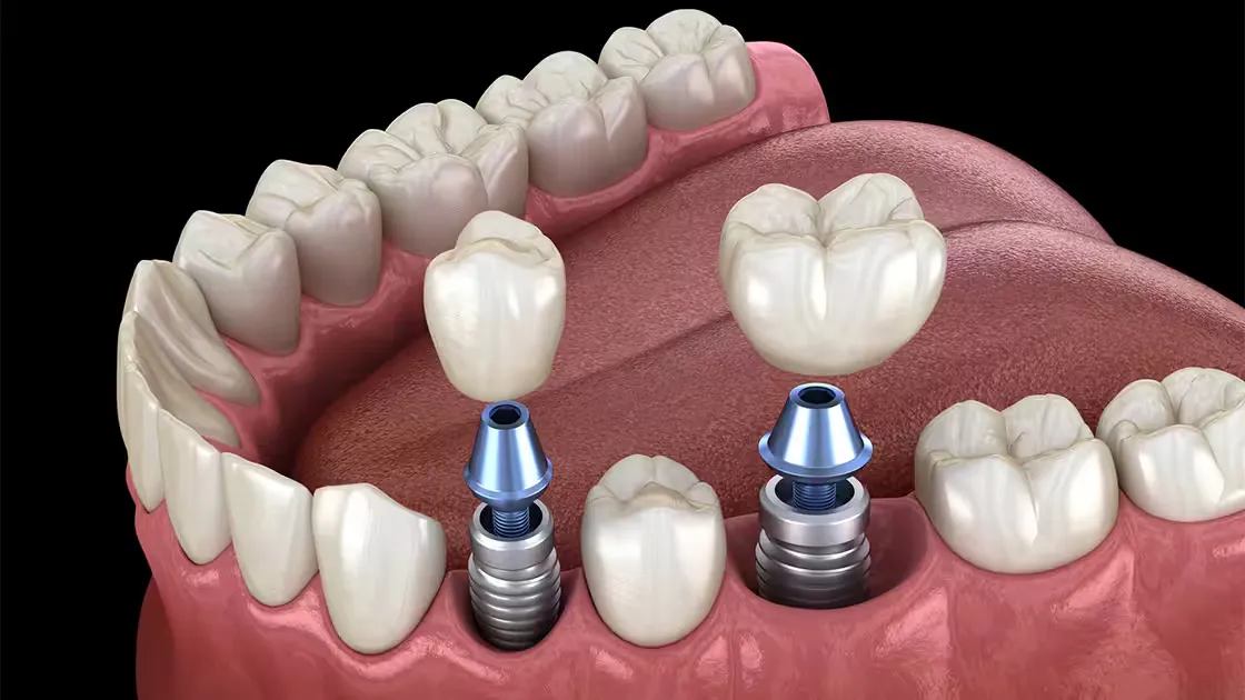 Northern Virginia Oral Surgery Centers
