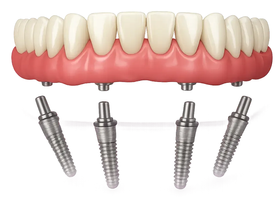 Simaya Prosthodontics