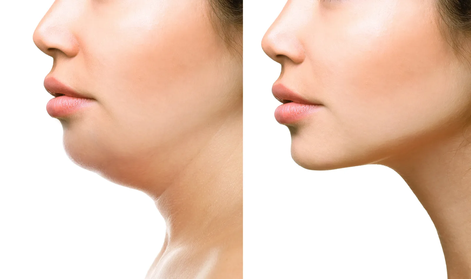 Revive Skin and Med Spa