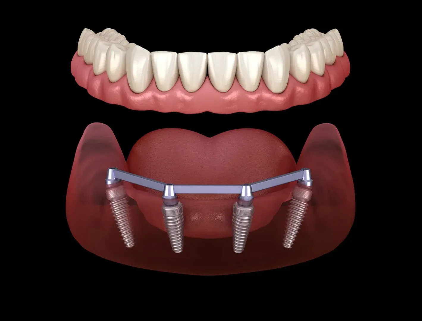 Pearly Whites of Pearland