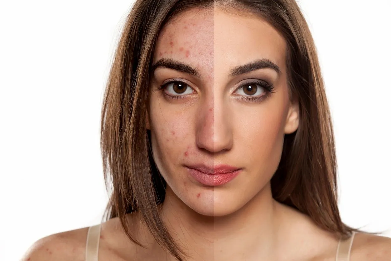 Allure Med Aesthetics